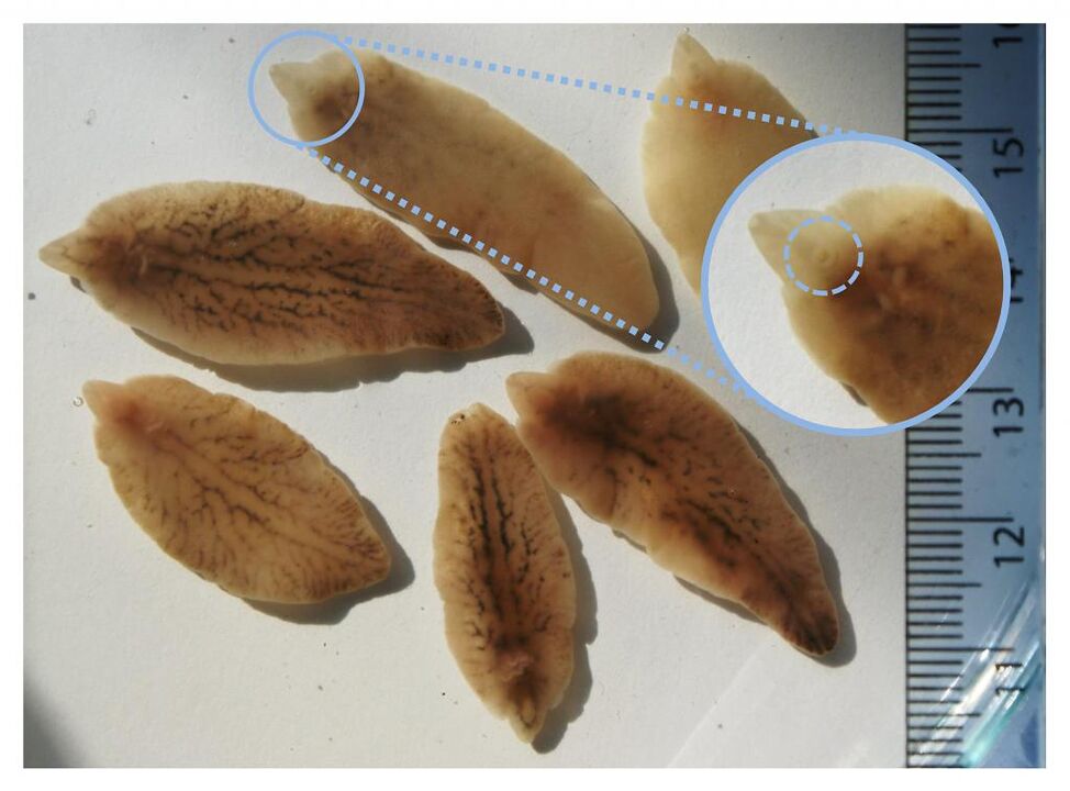 Liver fluxes