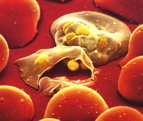The simplest parasite is malaria plasmodium