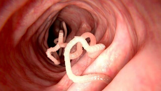 Worms that live in human intestines