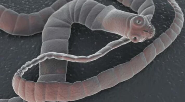 The worm